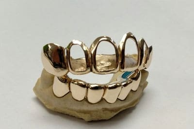 gold-teeth.jpg